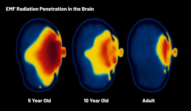 Diagram showing cell phone EMF radiation exposure.